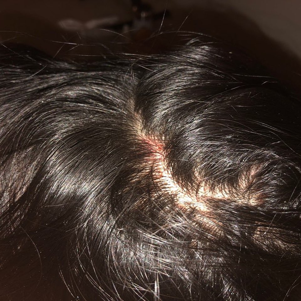 UBC student says no one intervened as she was attacked, robbed on Vancouver bus - image