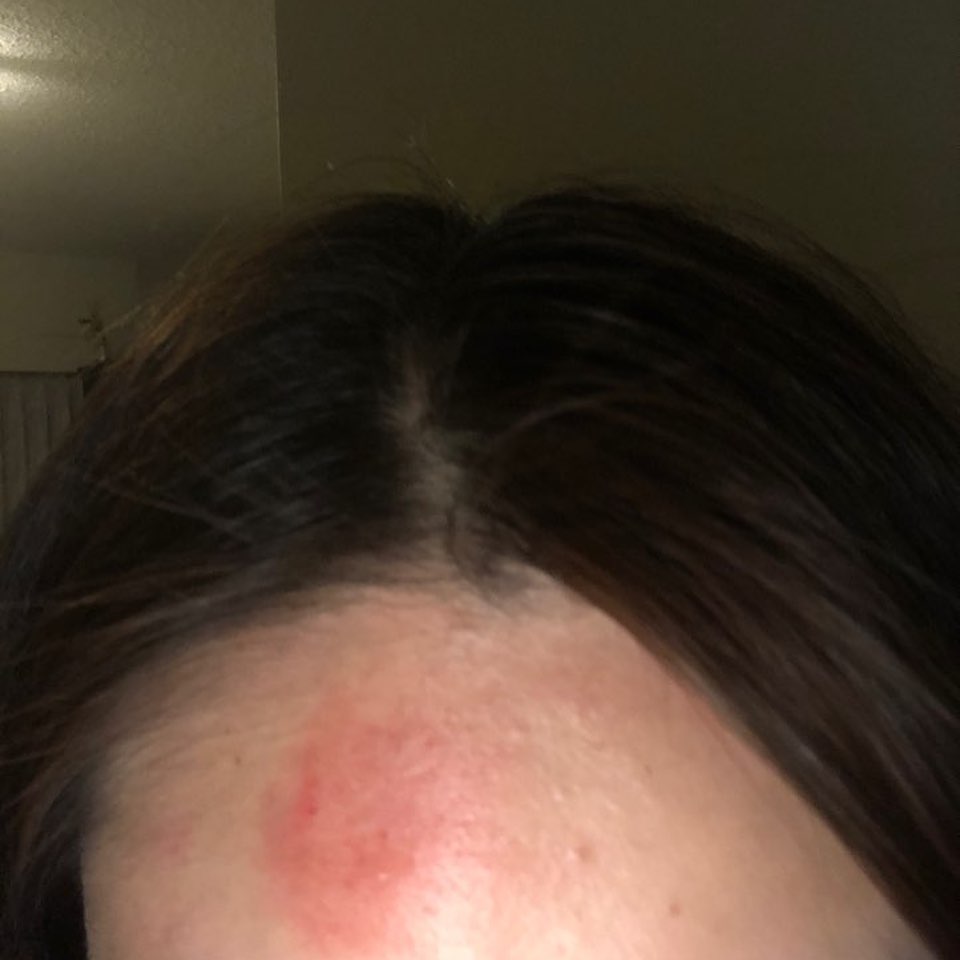 UBC student says no one intervened as she was attacked, robbed on Vancouver bus - image