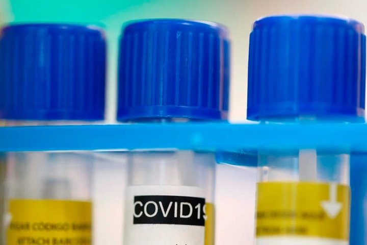 Ontario reports 88 coronavirus cases Monday, 91 cases Tuesday