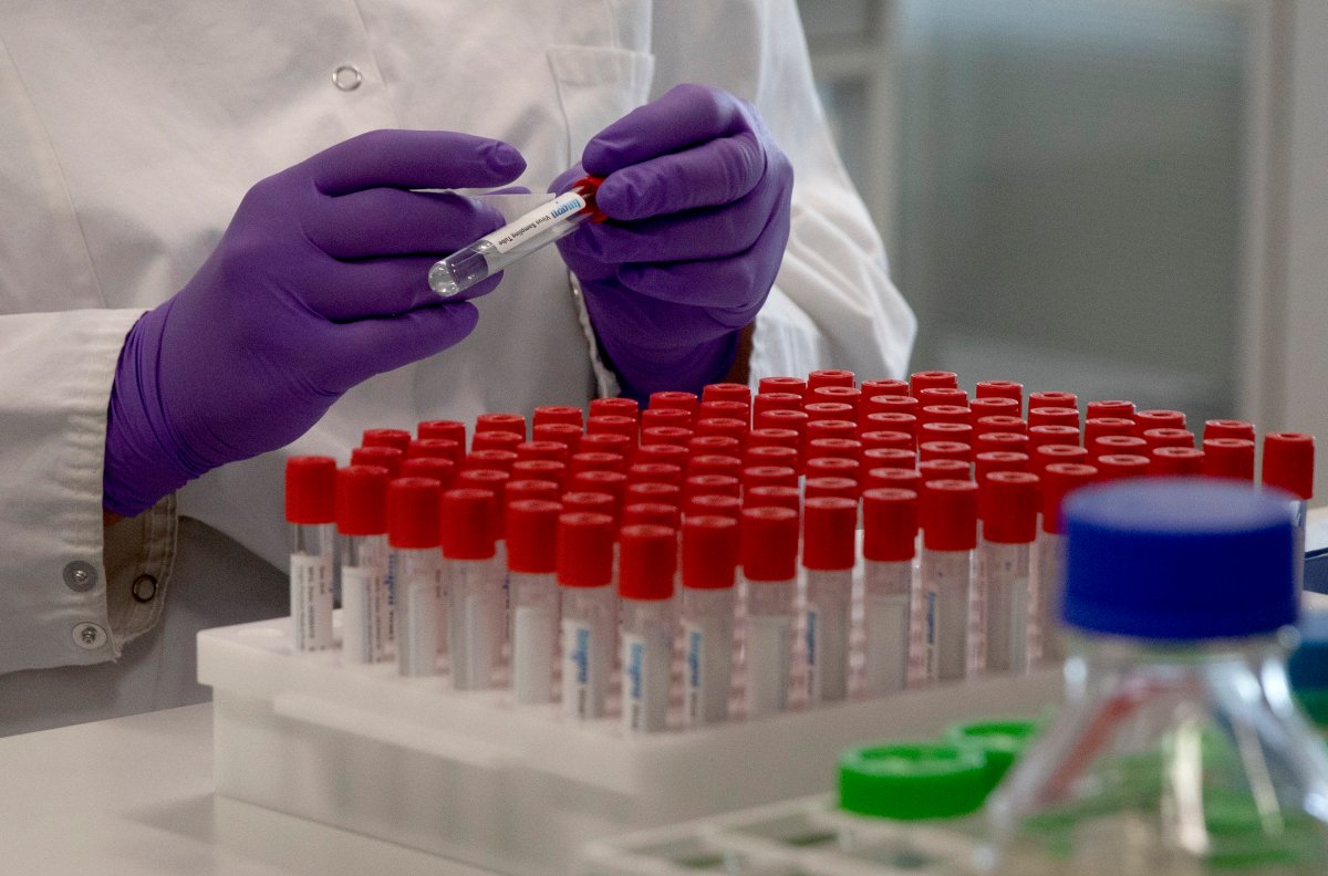 A lab technician looks puts a label on a test tube during research on coronavirus, COVID-19, at Johnson & Johnson subsidiary Janssen Pharmaceutical in Beerse, Belgium, Wednesday, June 17, 2020.