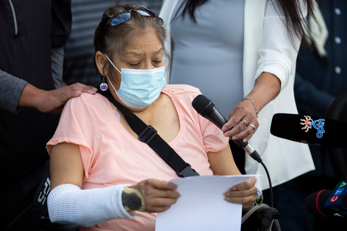 53-year-old Janette Sanderson, who is demanding answers after a medical treatment in Victoria Hospital which lead to severe disfiguring burns, speaks at a FSIN media event in Saskatoon, Sask., on Wednesday, Aug. 19, 2020. 