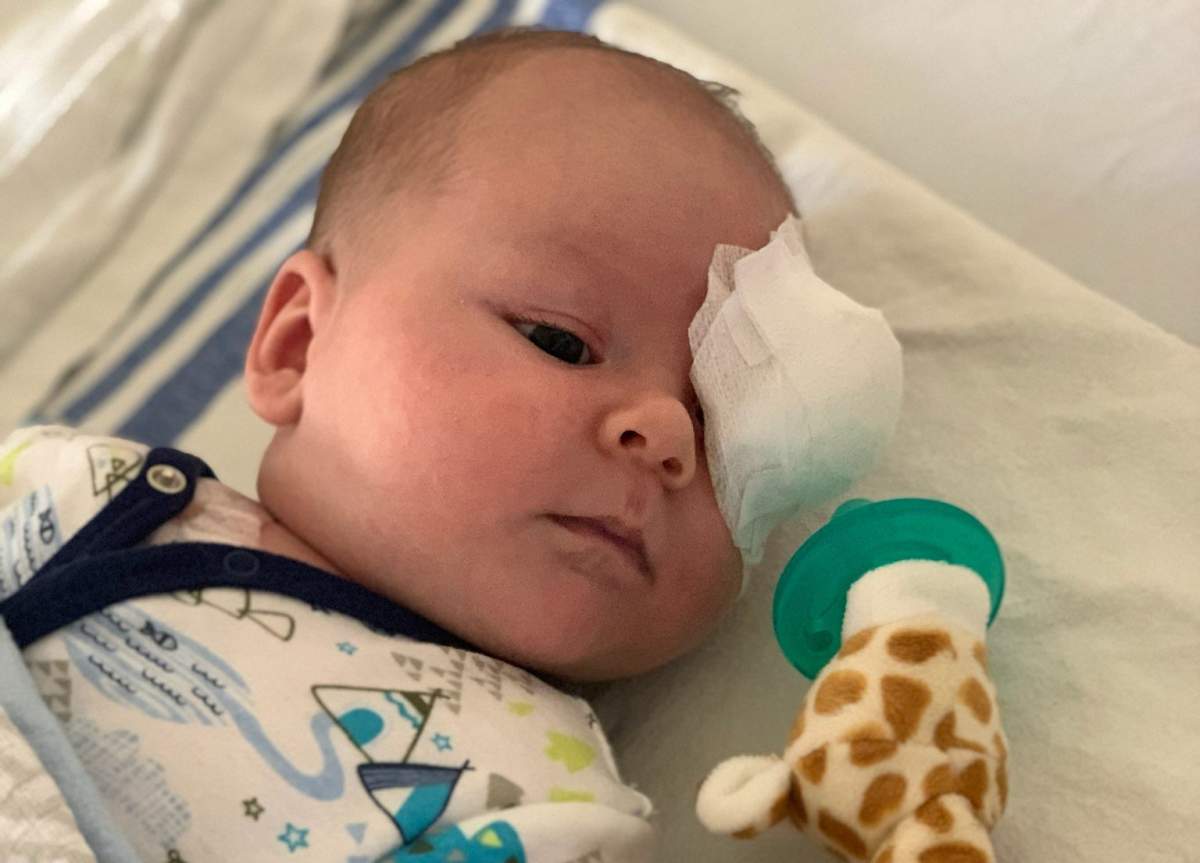 Baby Mason Cook has bilateral retinoblastoma. His left eye has been removed.