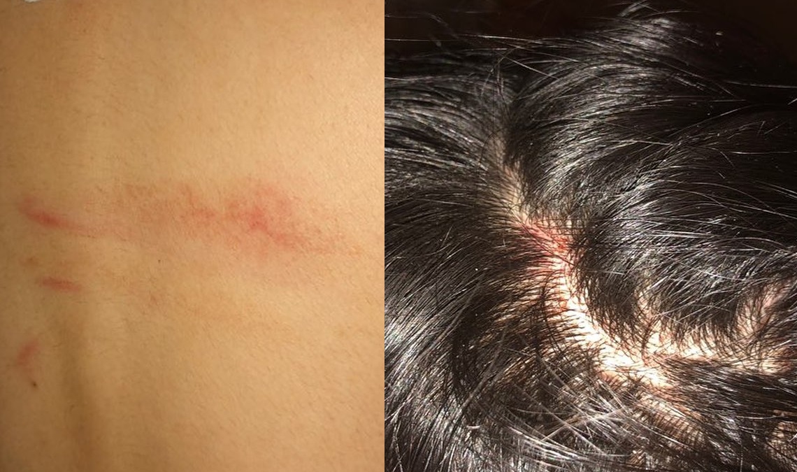 The woman says no one on the bus intervened while she was being assaulted by a group of young people. 