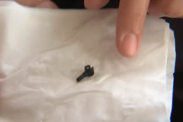 A Lego hand is shown after it fell out of Sameer Anwar’s nose in New Zealand.