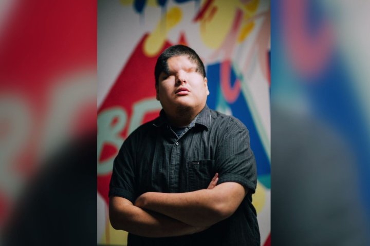 Blind Oji-Cree artist ‘Mattmac’ wins Canada’s Walk of Fame emerging musician prize