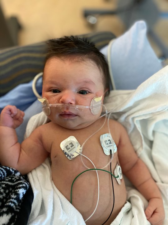 Calgary infant gaining weight and alert after recovering from COVID19