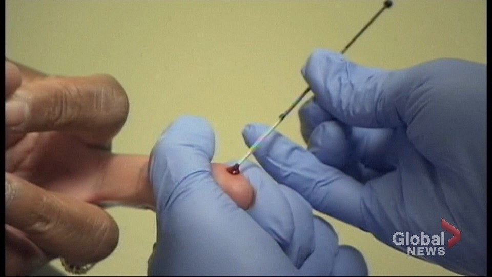 World AIDS Day: Calls continue for better HIV prevention in N.S. - image