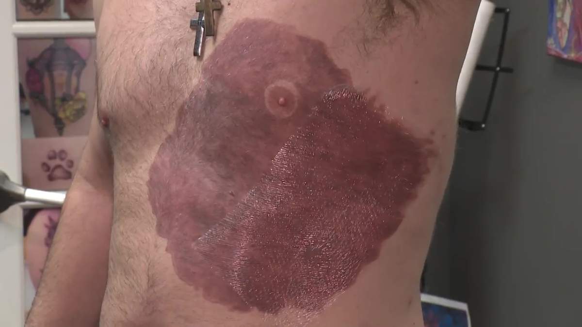 Derek Prue Sr. shows off his large birthmark tattoo, designed to look like his son\’s.