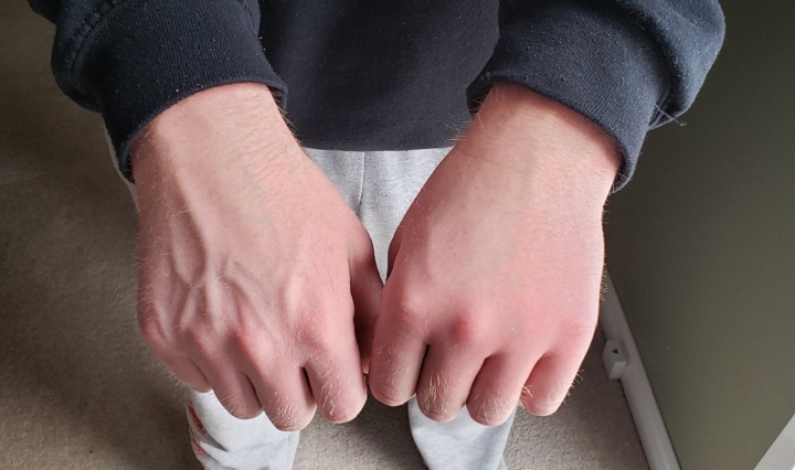 Jared Dormer’s hands were swollen after playing his cajon drum for nearly 26 hours straight.
