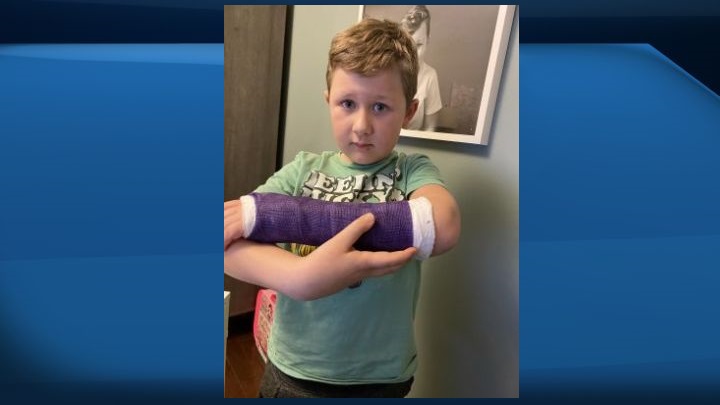 Parker Bohn of Edmonton broke his arm on an Edmonton toboggan hill on January 10, 2021. 