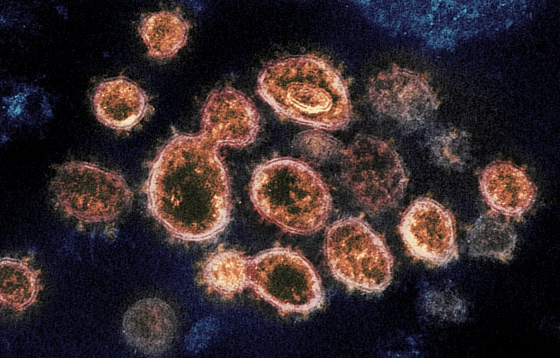An electron microscope image of SARS-CoV-2 virus particles, which cause COVID-19.
