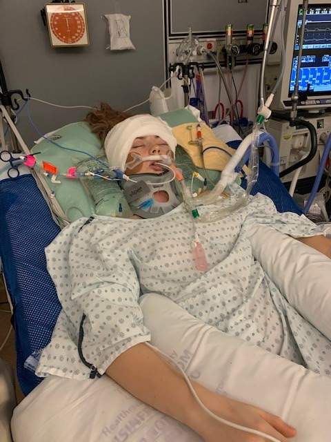 Grace Haines in hospital after a hit-and-run left her critically injured on Jan. 25, 2021.