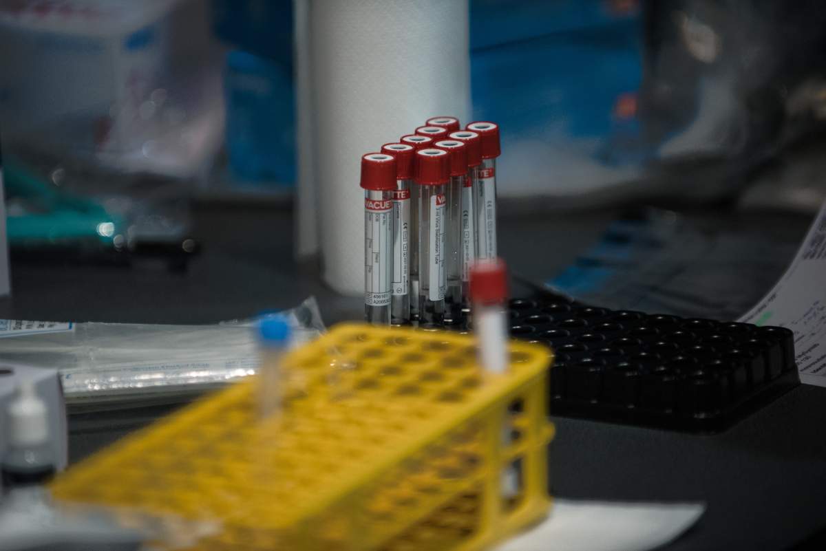 Saskatchewan reported 171 new coronavirus cases, two COVID-19-related deaths and 328 recoveries on Monday.