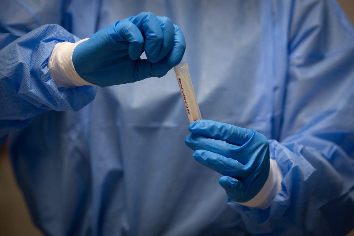 New Brunswick is reporting one new case of COVID-19 Thursday.