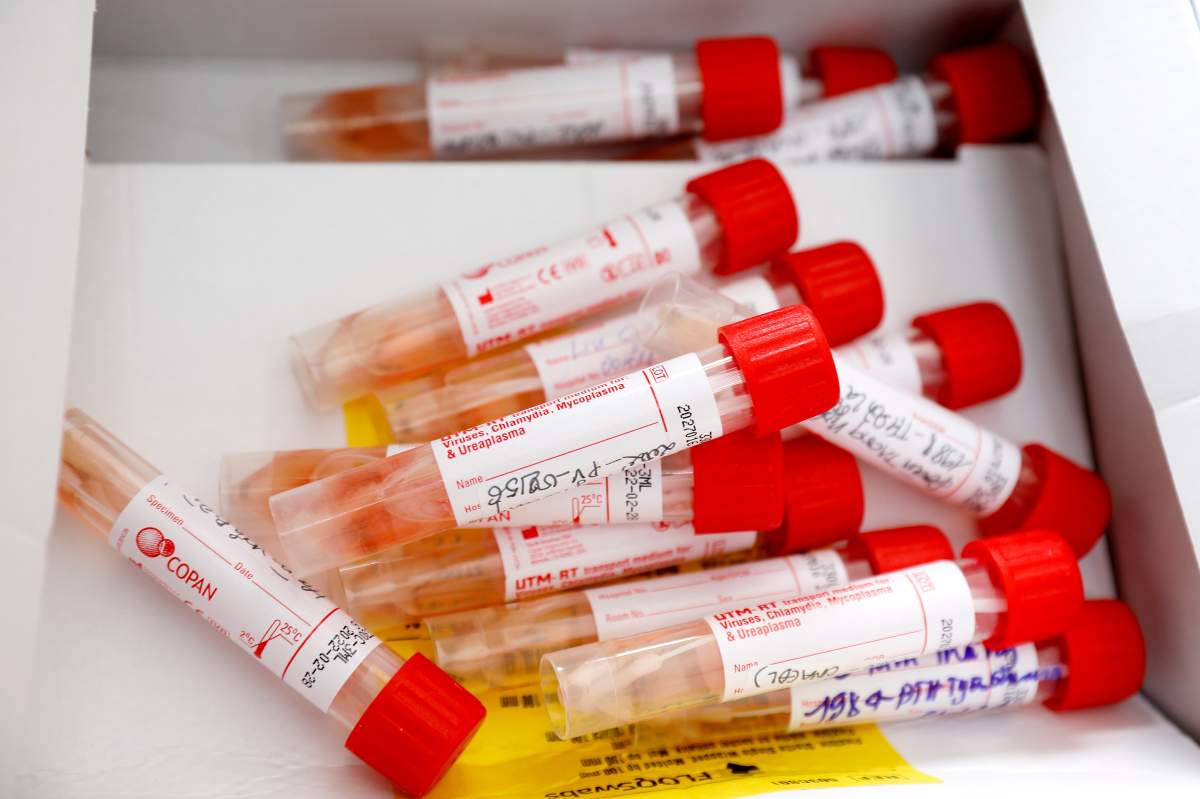 There are 146 new COVID-19 infections in Saskatchewan as of Thursday, according to health officials.