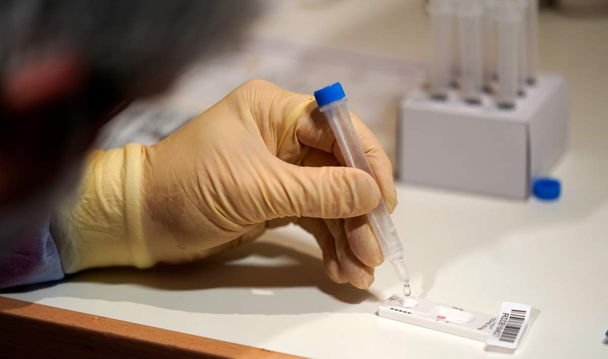 Peterborough Public Health says a resident has tested positive for a COVID-19 variant of concern.