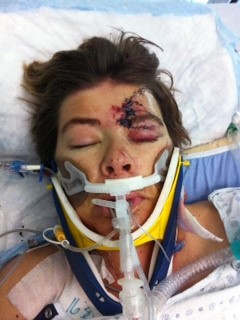 Among the most serious of her injuries, McHugh had a broken rib that had cut into her heart.