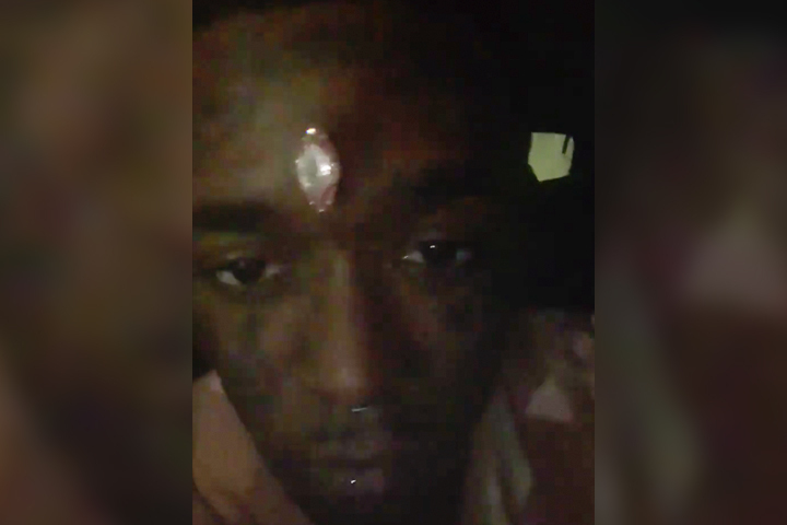 Lil Uzi Vert says fans ripped $24M 'Vision' diamond from his forehead -  National | Globalnews.ca
