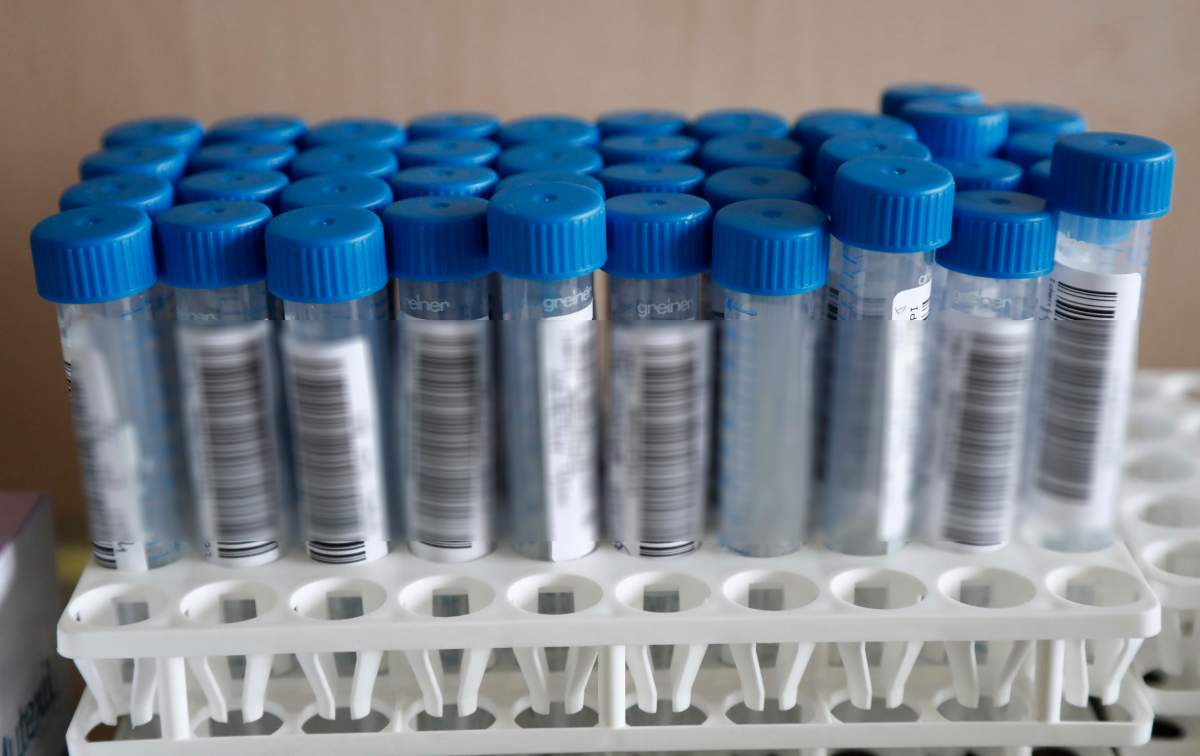 U.S. FDA approves 2 at-home rapid COVID-19 tests. When will Canada catch up? - image