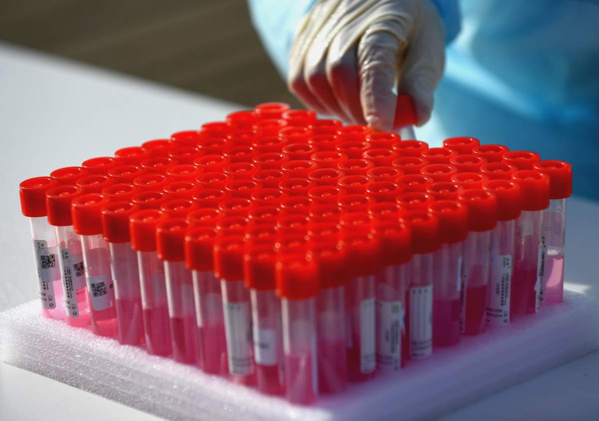 Manitoba reported three deaths connected to COVID-19 Wednesday along with 86 new infections.