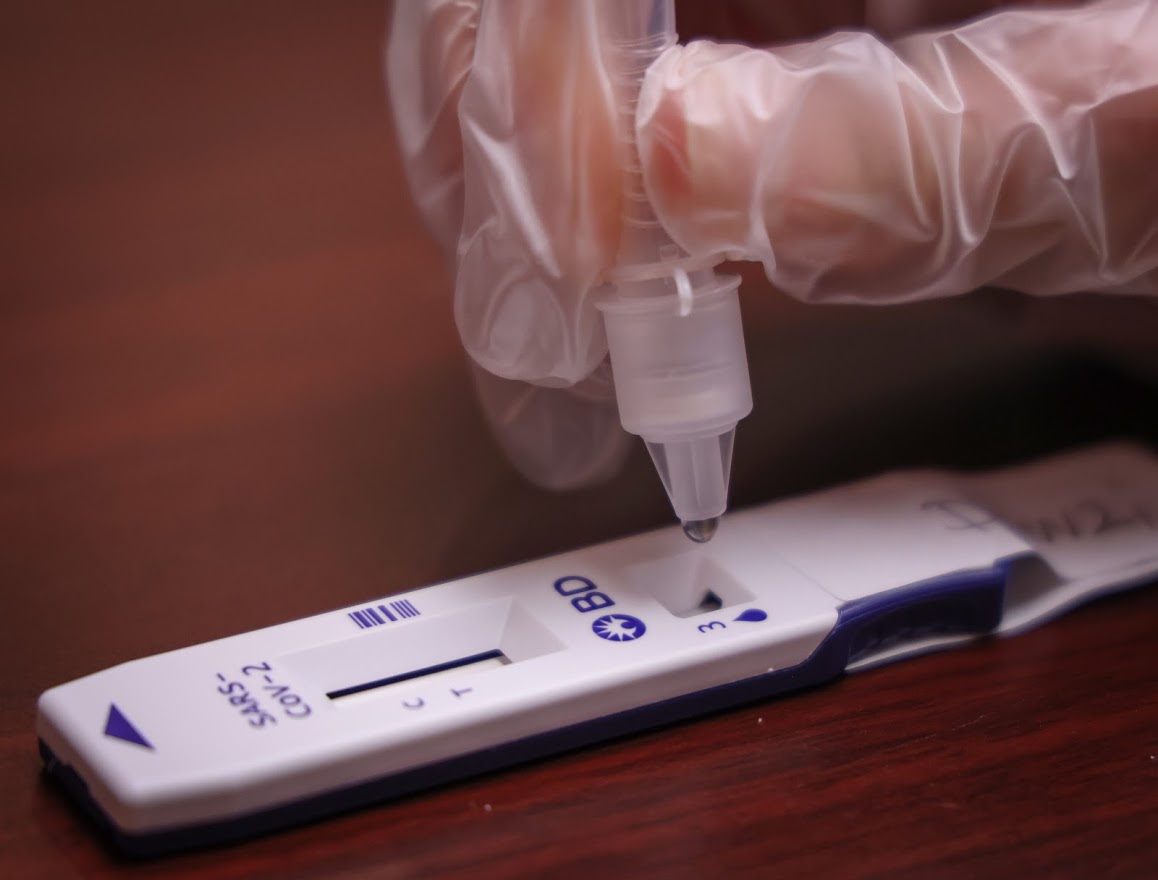 A health-care worker conducts a COVID-19 rapid test in Calgary on March 1, 2021.