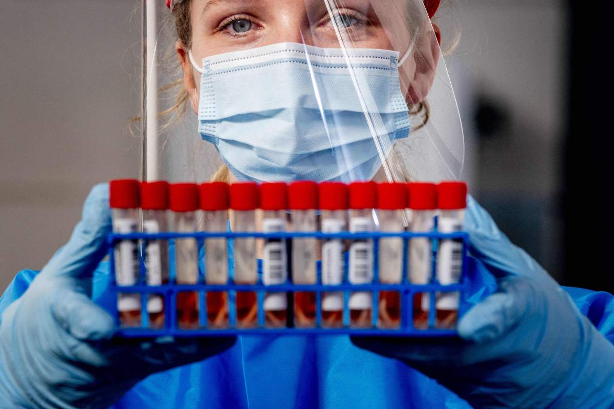 Peterborough Public Health reports 76 active cases of COVID-19 on Monday, April 26, 2021.