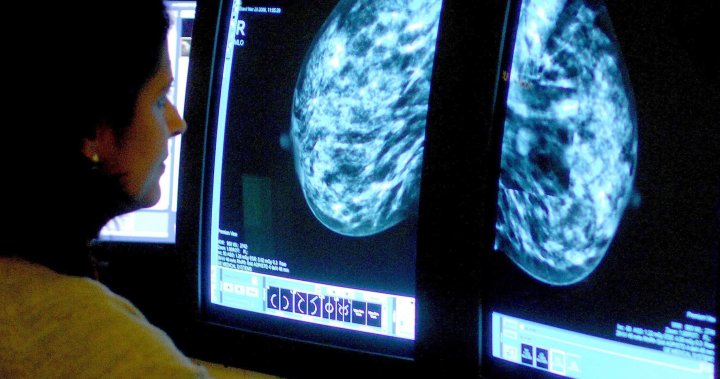 Стартира кампания за набиране на средства за тройно отрицателни изследвания за рак на гърдата