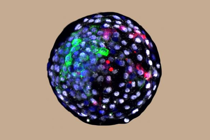 This image shows a chimera human-monkey blastocyst. 