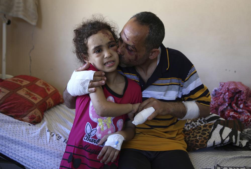 Suzy Ishkontana, 7, is kissed by her father Riad Ishkontana, 42, at Shifa Hospital in Gaza City, Tuesday, May 18, 2021. Suzy and her father Riad were the only survivors of their family after an Israeli airstrike destroyed one of the buildings they lived in in Gaza City early Sunday, killing her mother and four siblings.