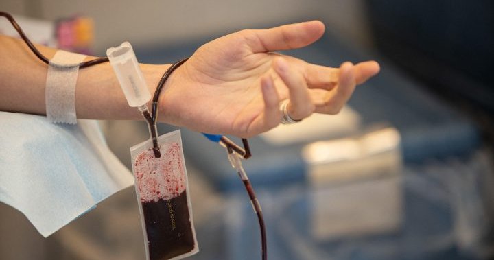 Blood donation urgently needed in Edmonton as backlogged surgeries ramp up – Edmonton | Globalnews.ca