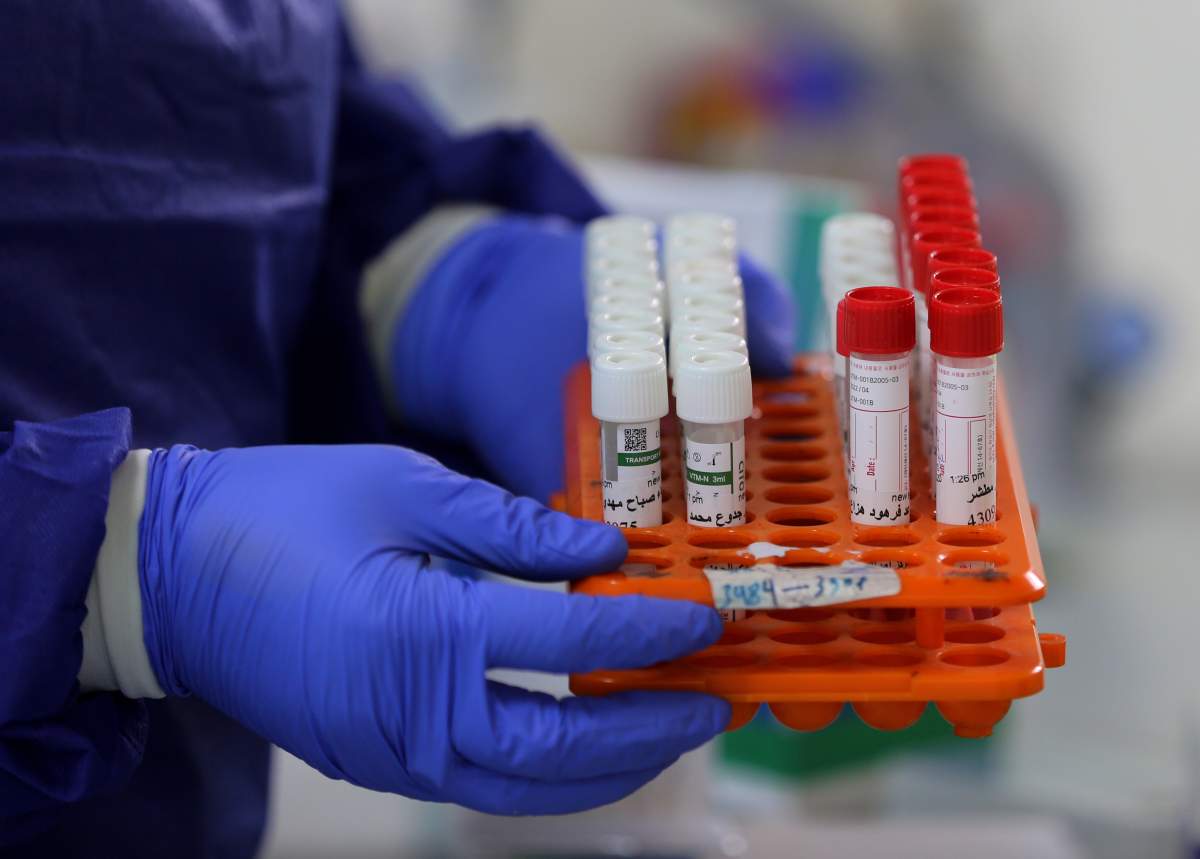 Manitoba is reporting 11 more deaths linked to COVID-19 and 111 new hospitalizations for the week of March 20-26. On Thursday the province announced it is permanently closing all provincial COVID-19 testing sites as of April 15.