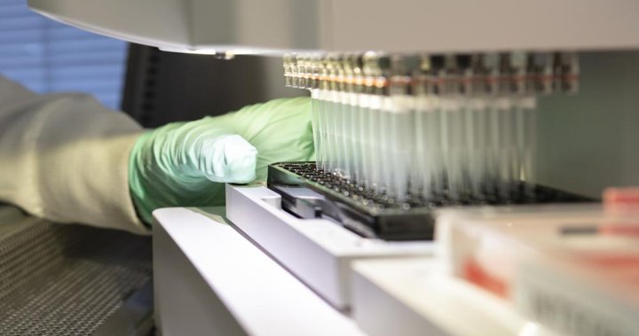 Университетът на Манитоба получава „революционно“ финансиране за изследване на ваксини и биопроизводство