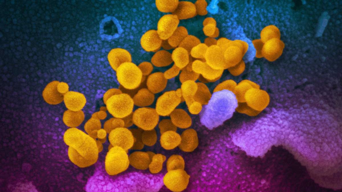 This undated electron microscope image made available by the U.S. National Institutes of Health in February 2020 shows the Novel Coronavirus SARS-CoV-2, yellow, emerging from the surface of cells, blue/pink, cultured in the lab. Also known as 2019-nCoV, the virus causes COVID-19. THE CANADIAN PRESS/AP-NIAID-RML via AP.