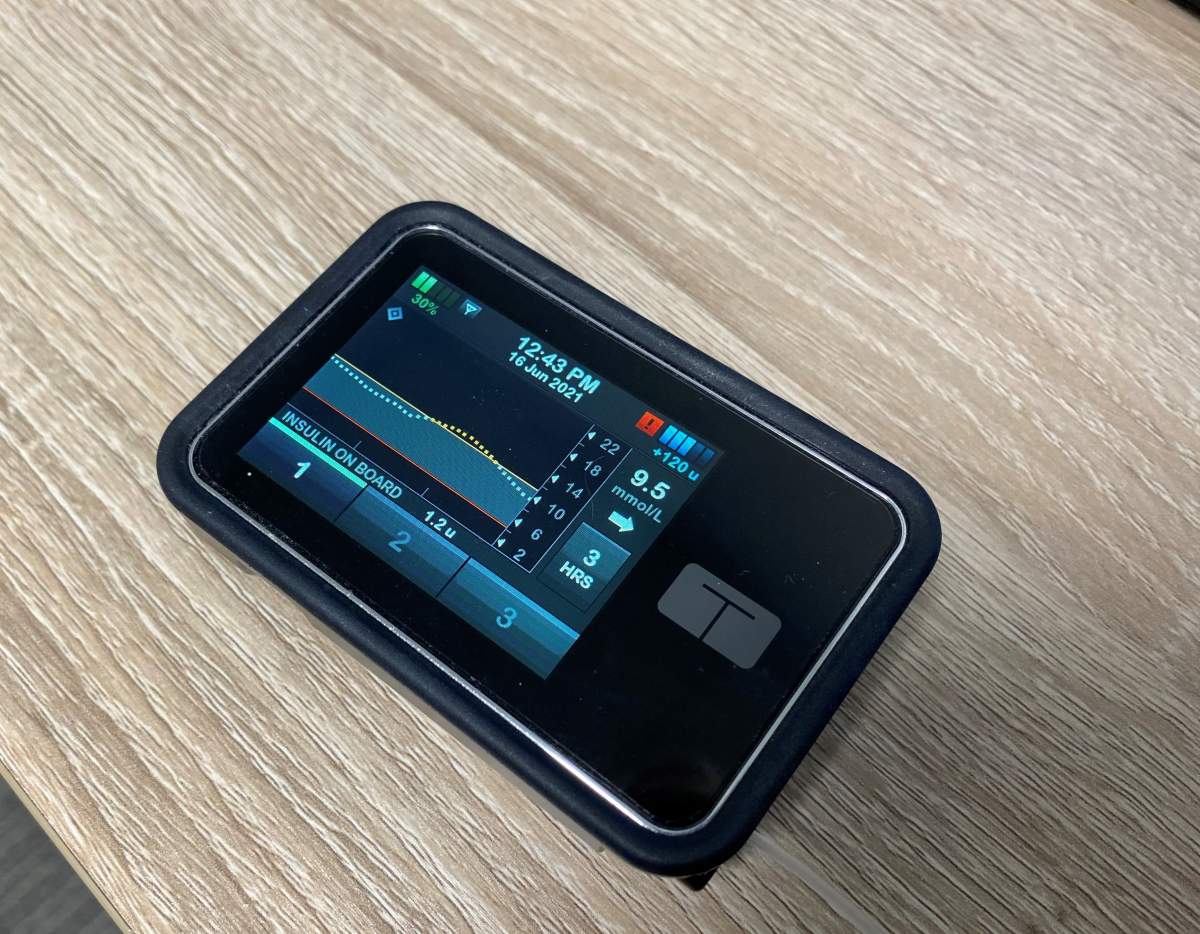 Diabetes Canada is making the call once again for New Brunswick and Nova Scotia to remove the age cap on their insulin pump programs. 