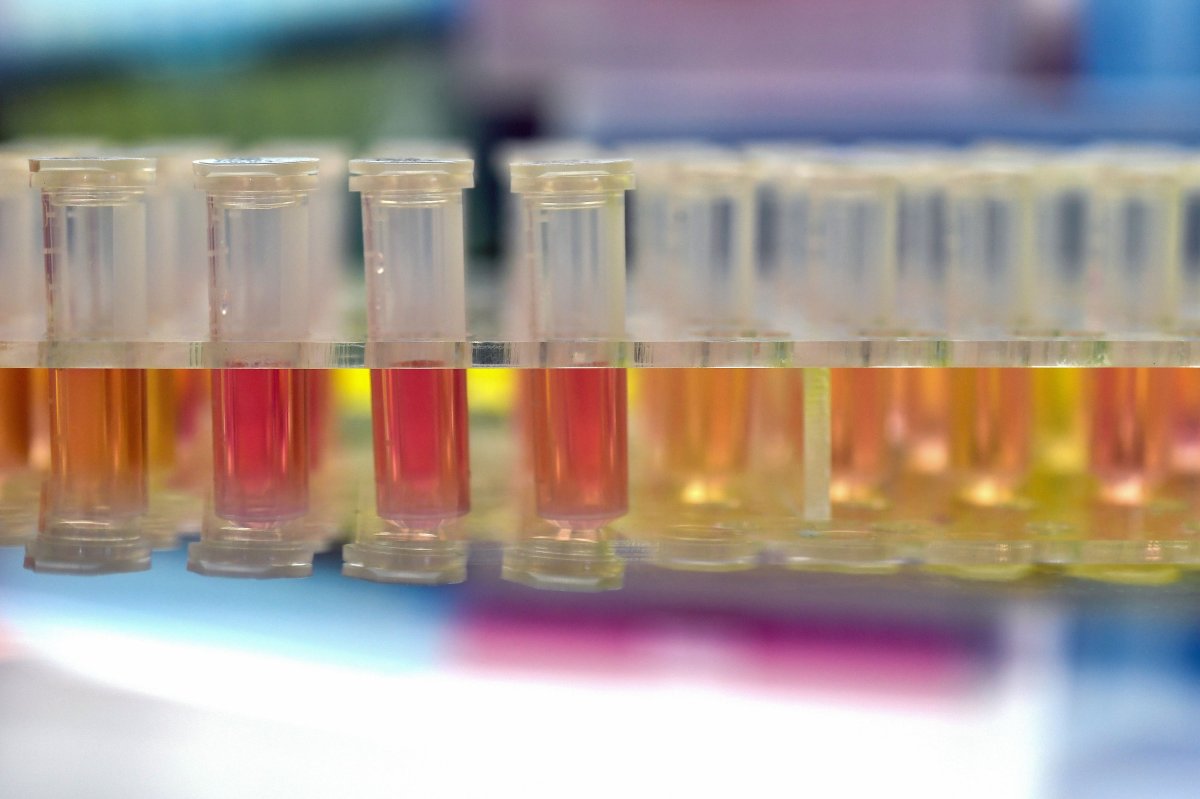 This photo taken on Feb. 6, 2020 shows samples from people to be tested for the new coronavirus at the BGI Group's "Fire Eye" laboratory in Wuhan in China's central Hubei province.