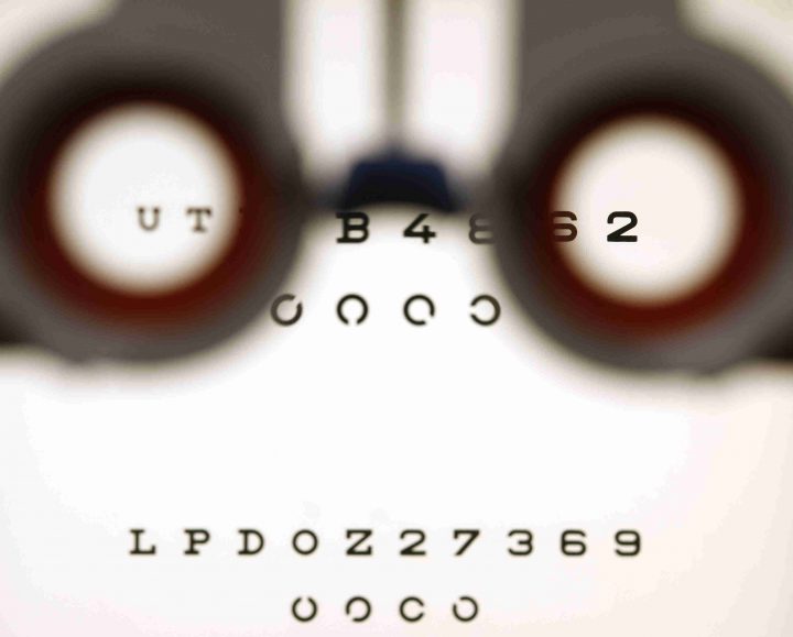 An optometrist holds glasses in front a lightbox in this file photo.