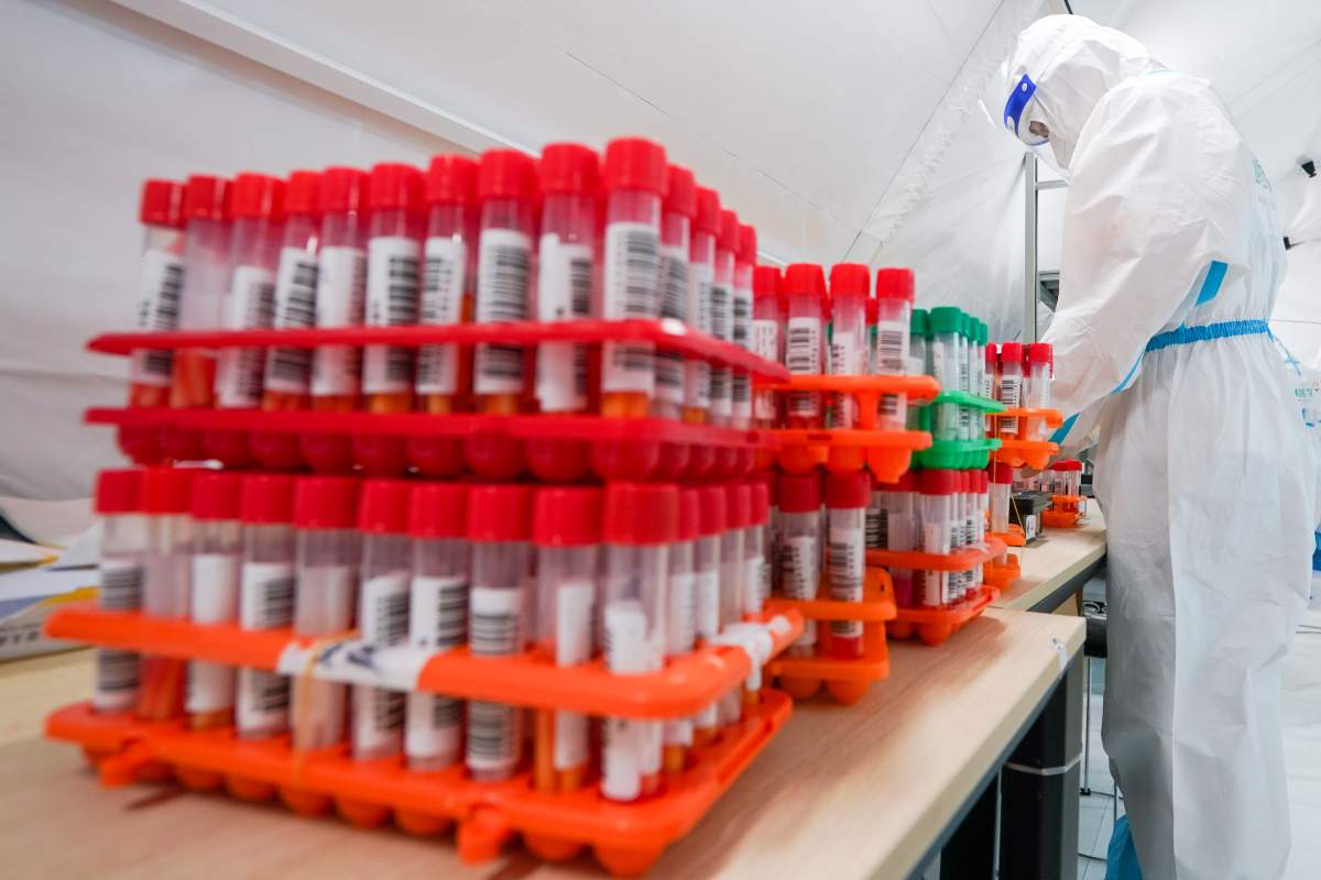 Saskatchewan reported 449 new cases on Monday, its highest one-day total since the start of the pandemic.