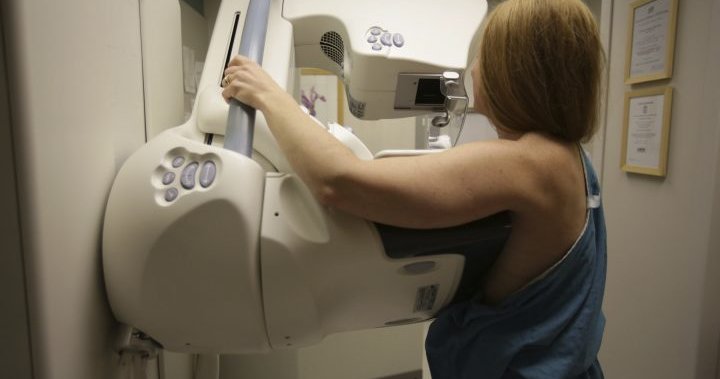 ‘Outdated’ breast cancer screening guidelines failing Canadian women: report