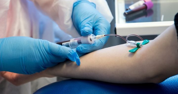 Canadian Blood Services expands eligibility for some gay men to donate plasma at certain clinics