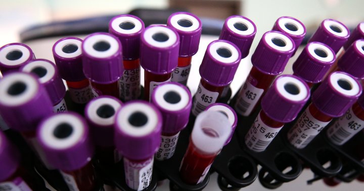 Russia counting on COVID-19 antibody tests. Western experts say it’s unwise