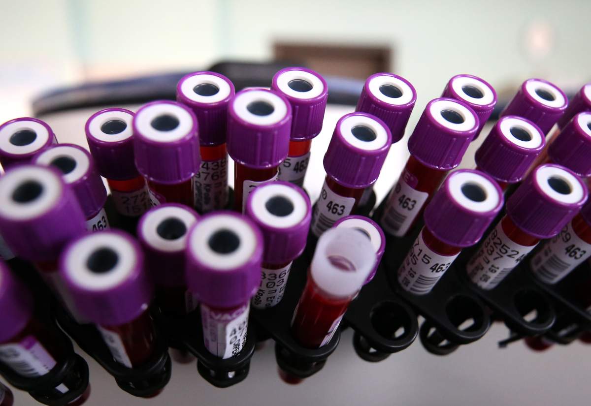 Saskatchewan reported Tuesday that 340 people were in hospital due to COVID-19, 73 of whom were in intensive care.