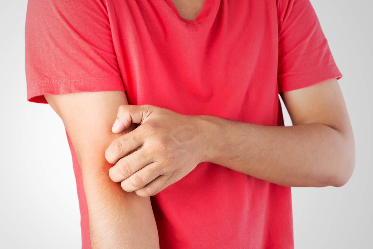 Eczema Society of Canada