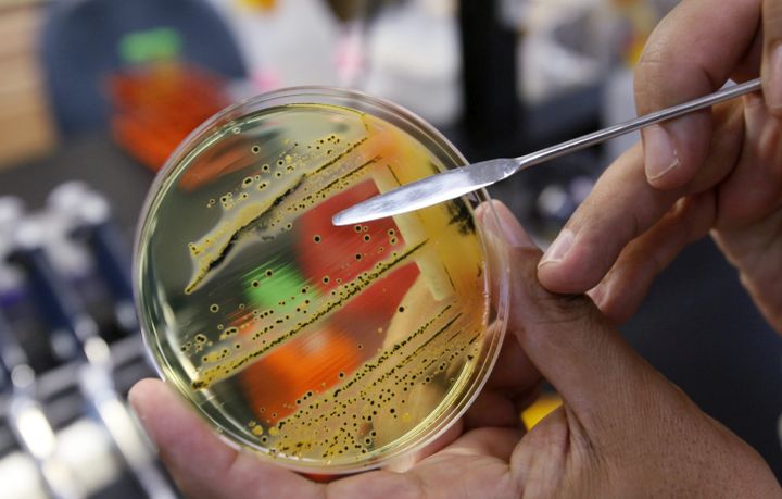 A doctor points out a growth of salmonella in a petri dish at IEH Laboratories Monday, May 17, 2010, in Lake Forest Park, Wash. 