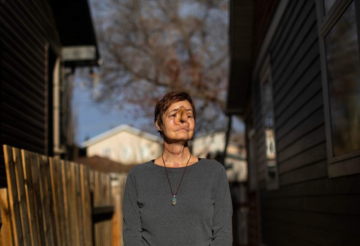 Sharon Durham pictured in Edmonton on Monday November 8, 2021. Durham had her rare cancer surgery cancelled in Saskatchewan and then rescheduled in Edmonton when Alberta was at the peak of its fourth wave.