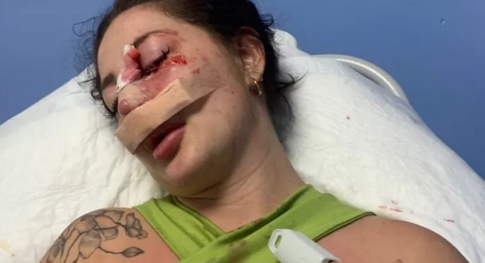 Woman who’d been stalked in Vancouver is brutally attacked in Mexico