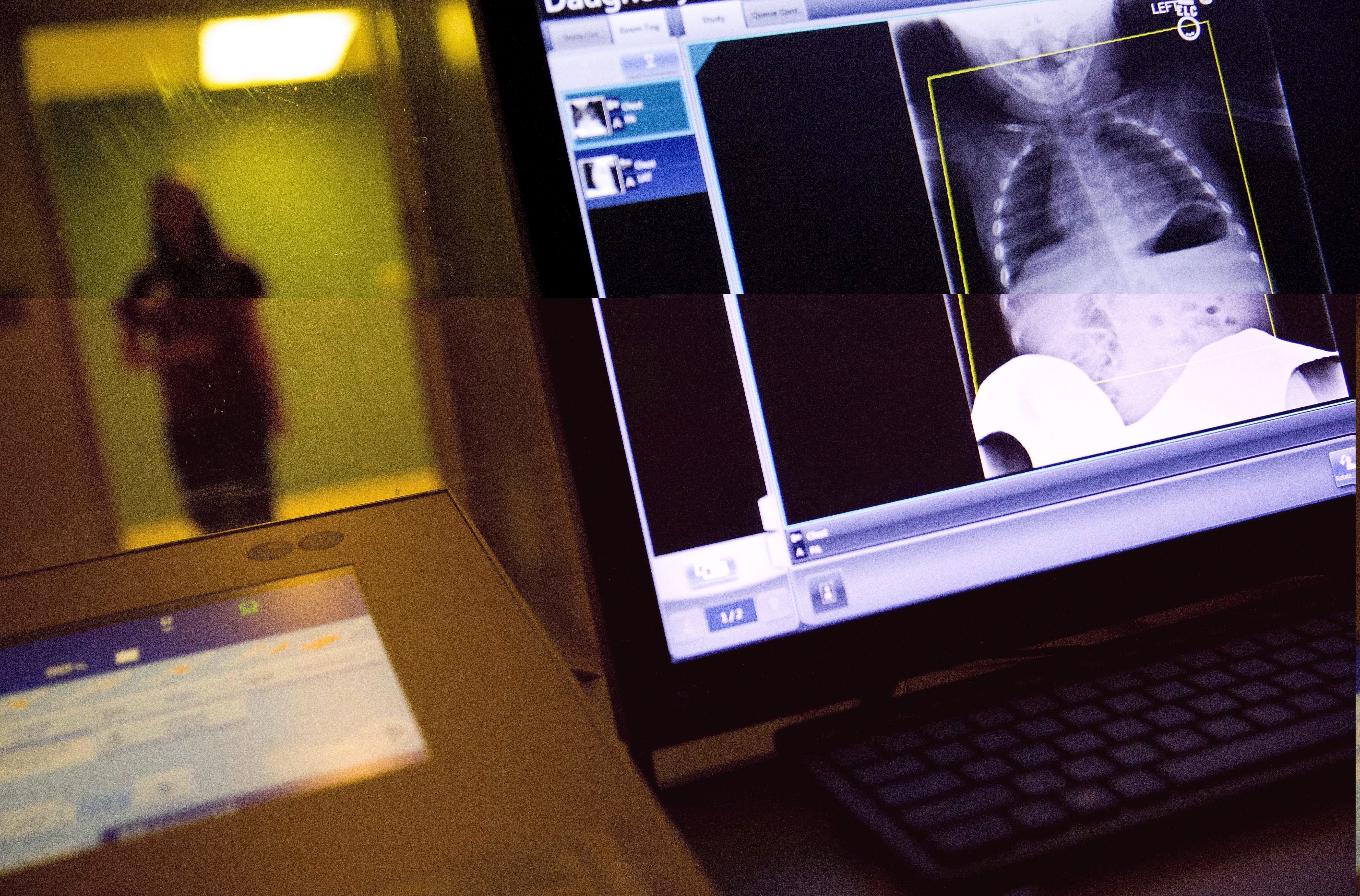 Medical Imaging Backlogs Plaguing Canadian Hospitals Radiologists Warn   RadiologyOmicronCovidfile 