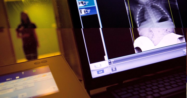 Medical imaging backlogs plaguing Canadian hospitals, radiologists warn