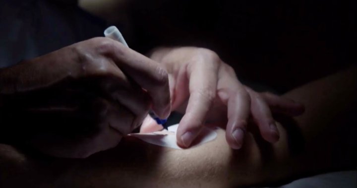 University of Alberta study shows positive signs to get patients with diabetes off injected insulin