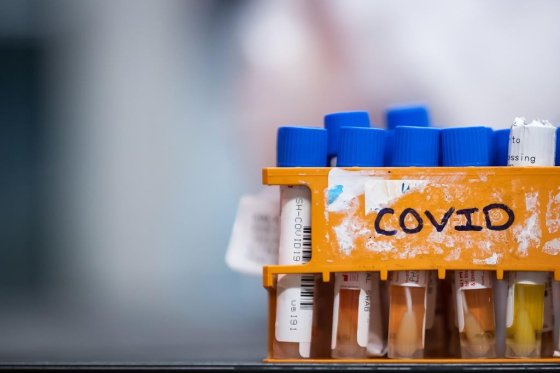 covid specimens samples coronavirus