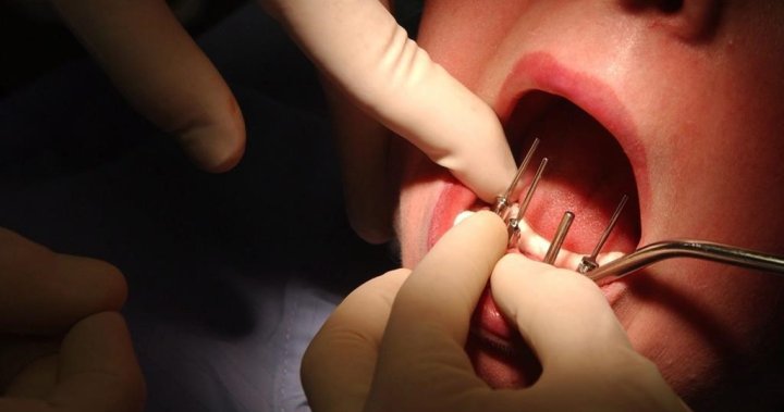 Зъболекар е съден за извършване на 4 коренови канала, 8 коронки, 20 пломби за един ден